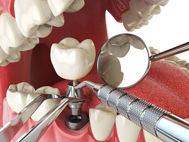 Best Emergency Dental Surgery in Lennox, CA